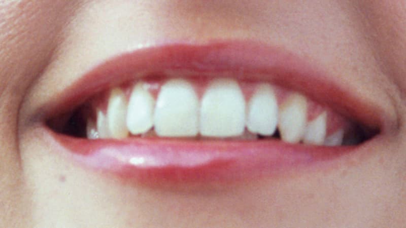 patient smile