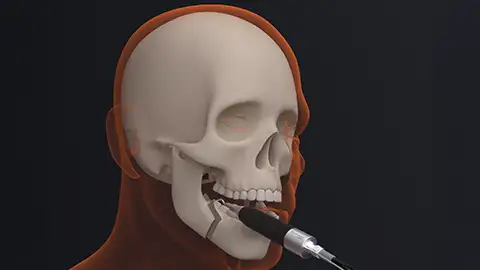 Correction of skeletal dysmorphologies