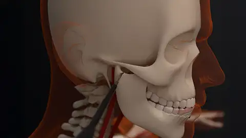Temporo-mandibular joint disorders
