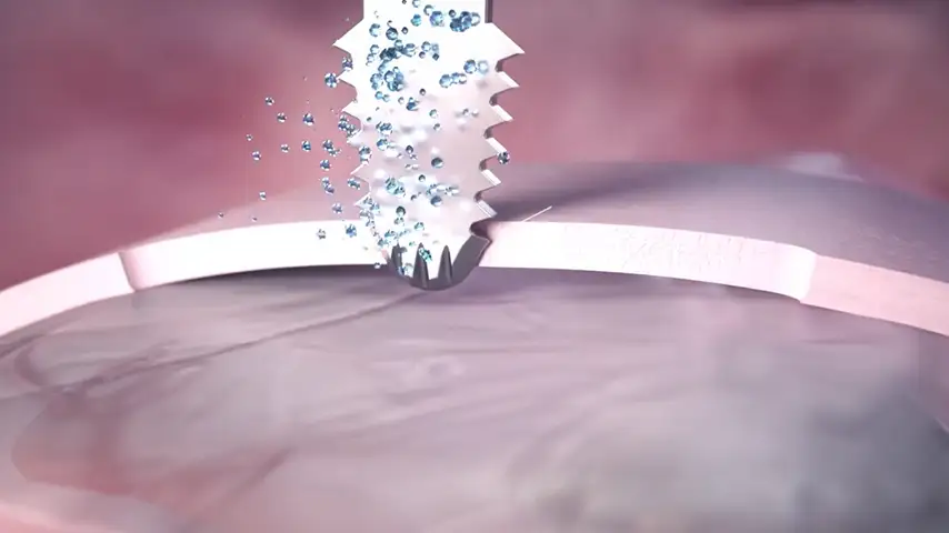 Micrometric cut