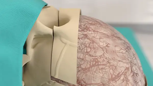 Exceptional precision