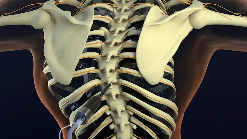 Correction of Deformities